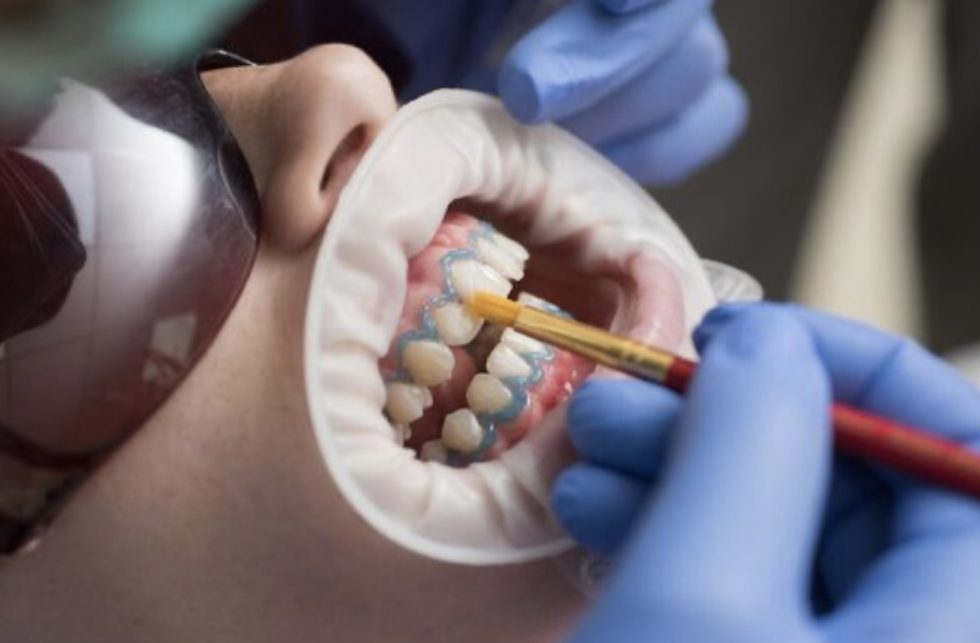 Teeth whitening plus 2