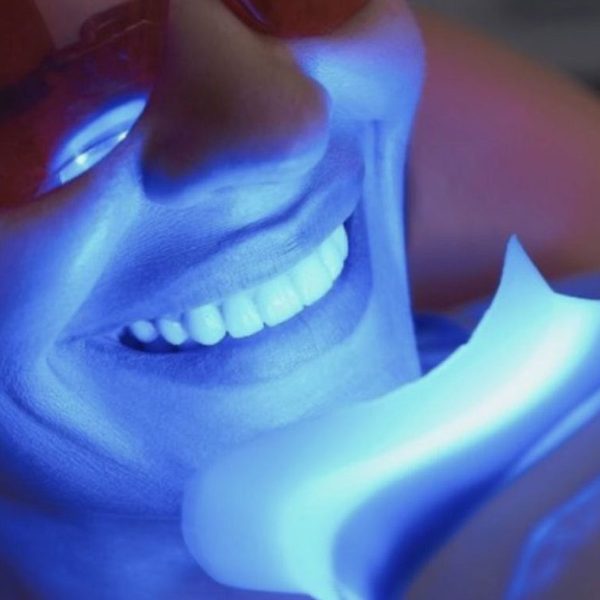 Classic Glow 45 min $320